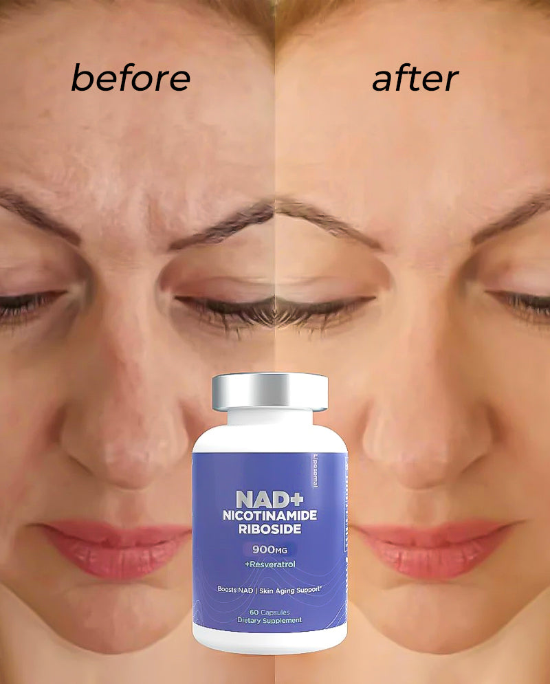 Nicotinamide Riboside (NR) Formula – Supports Energy Metabolism & Cellular Health