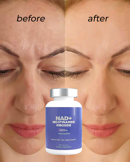Nicotinamide Riboside (NR) Formula – Supports Energy Metabolism & Cellular Health